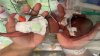 Récord Guinness para bebé que sobrevivió tras nacer a las 21 semanas de gestación